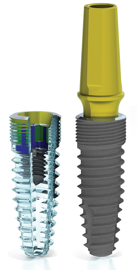 Prodent Prime impianto conico root-form